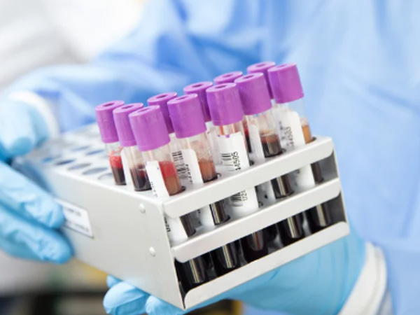 stem-cell-transit-real-time-monitoring-with-4g-temperature-data-tracker1.jpg