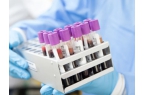 Stem Cell Transit Real-Time Mo